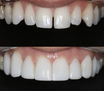 smilemakeover
