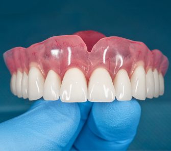 denture. Full removable denture of the upper jaw of man with white beautiful teeth in the hand of a dentist. Aesthetic Dentistry